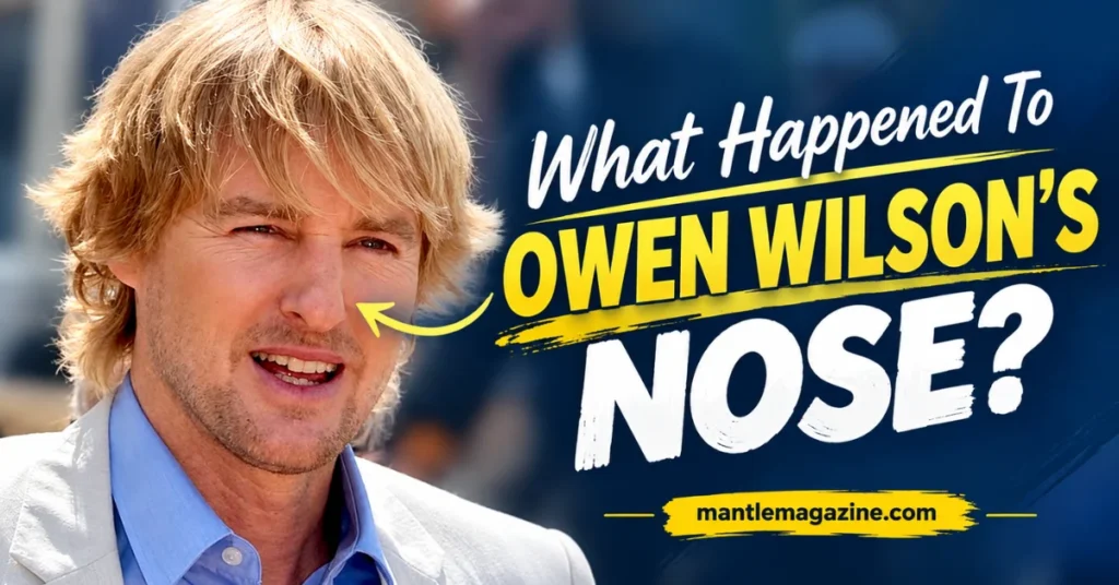 Owen Wilson smiling as an arrow points to his signature nose